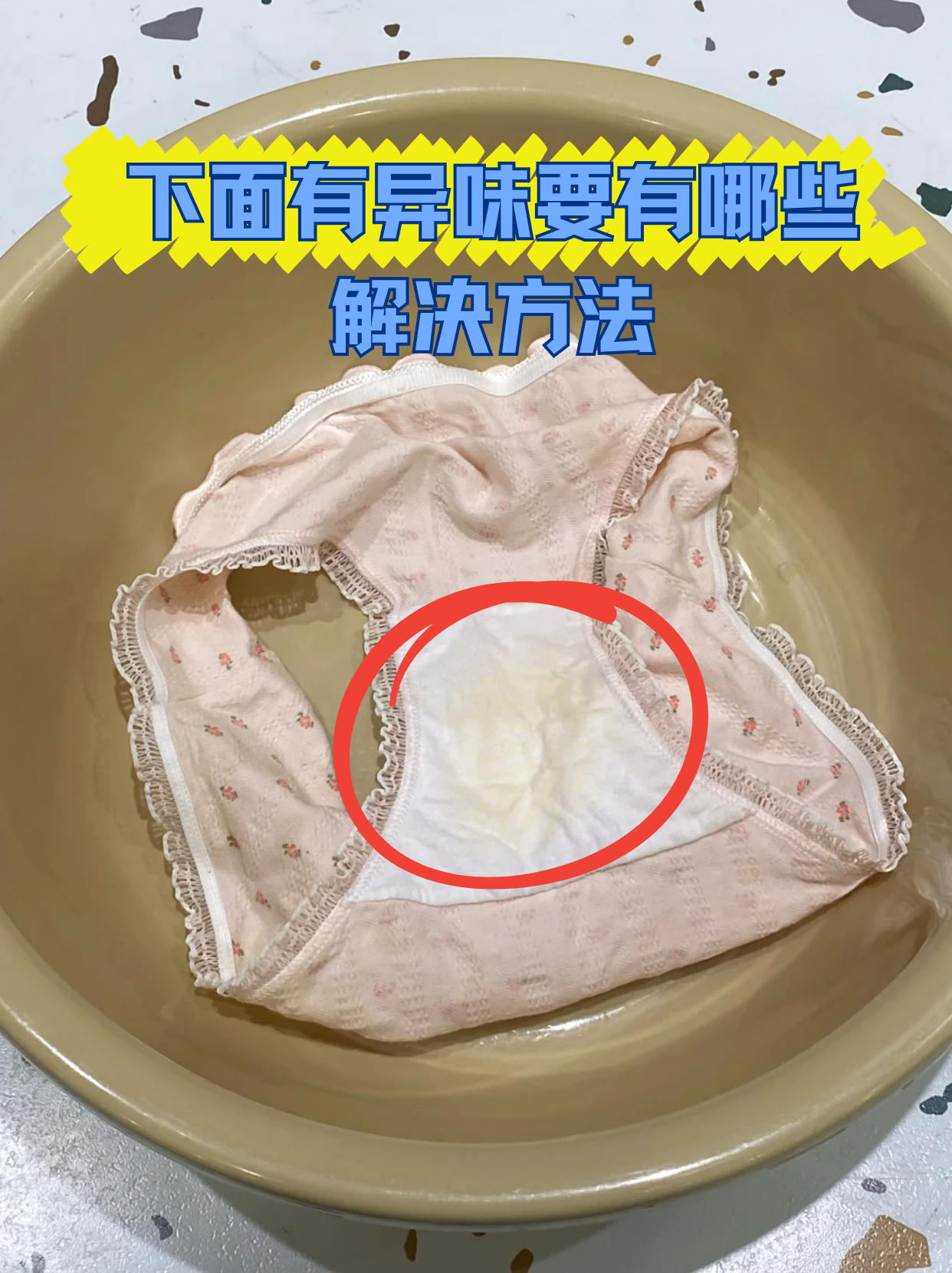 下面有异味要有哪些解决方法