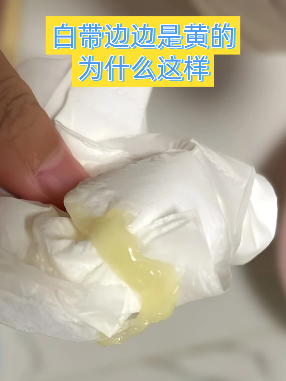 白带边边是黄的为什么这样
