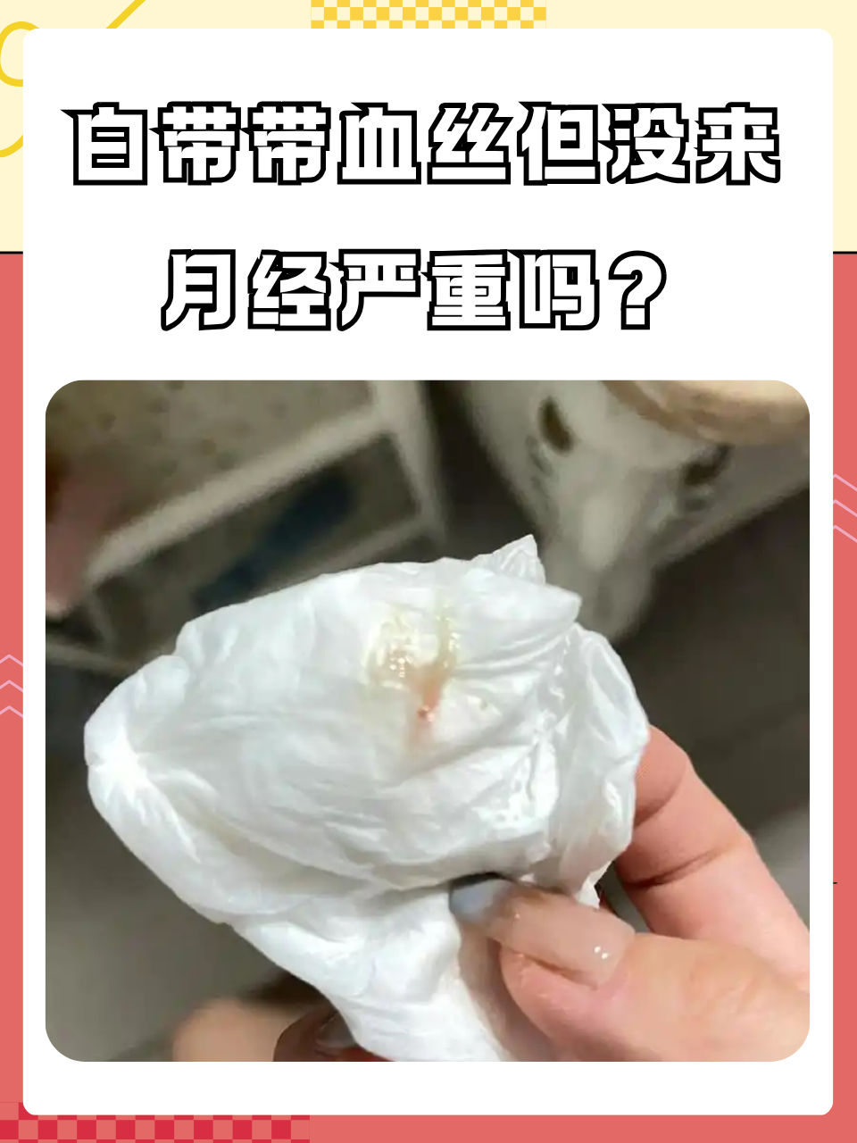 白带带血丝但没来月经严重吗?