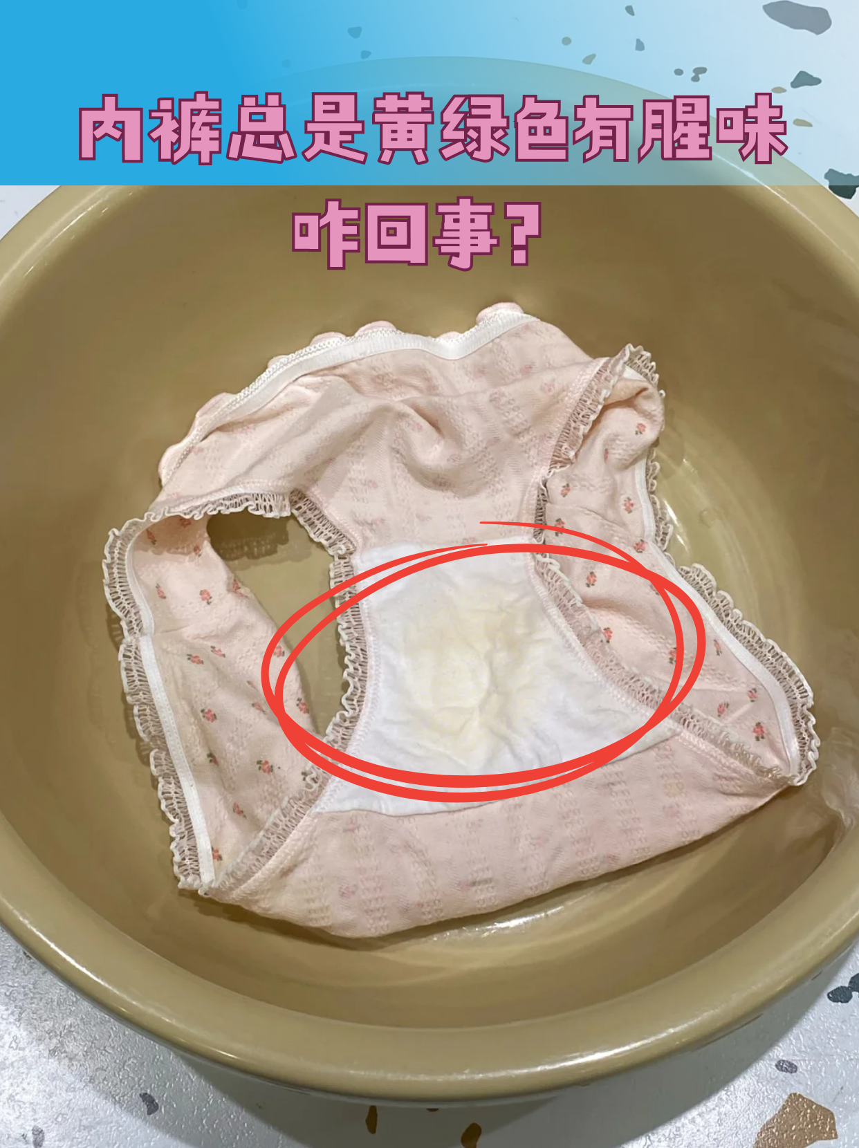 内裤总是黄绿色有腥味咋回事?