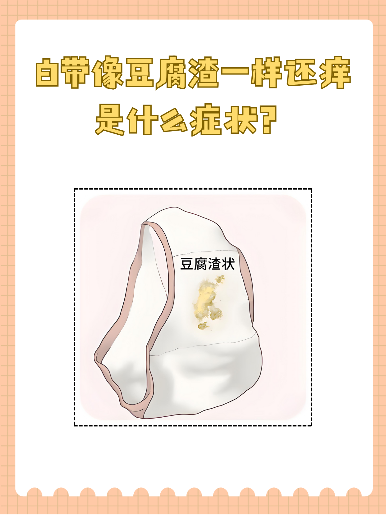 白带像豆腐渣一样还痒是什么症状?