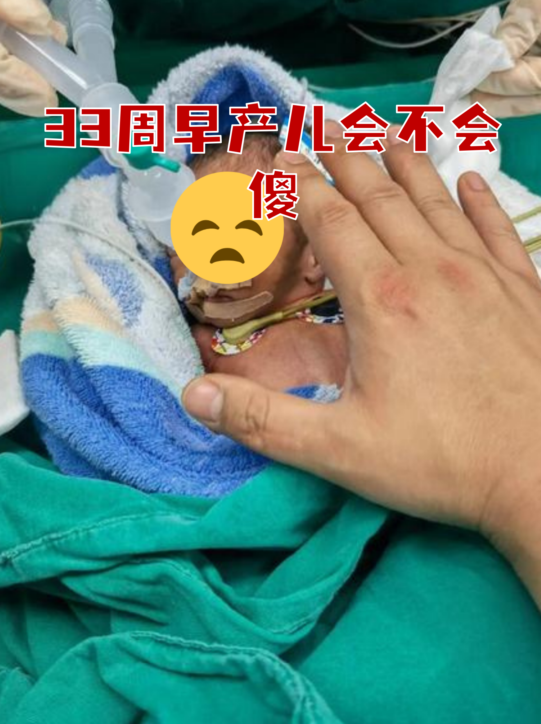 大部分孩子都能追上足月儿的成长步早产儿33周早产儿图片33周胎儿真实