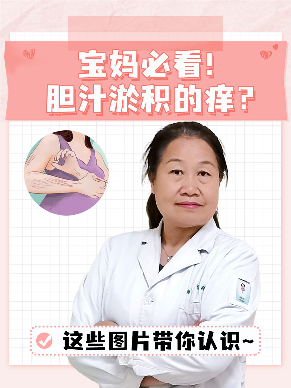 孕妇胆汁淤积瘙痒图片  93孕妇在孕期可能会遇到各种身体变化和挑战