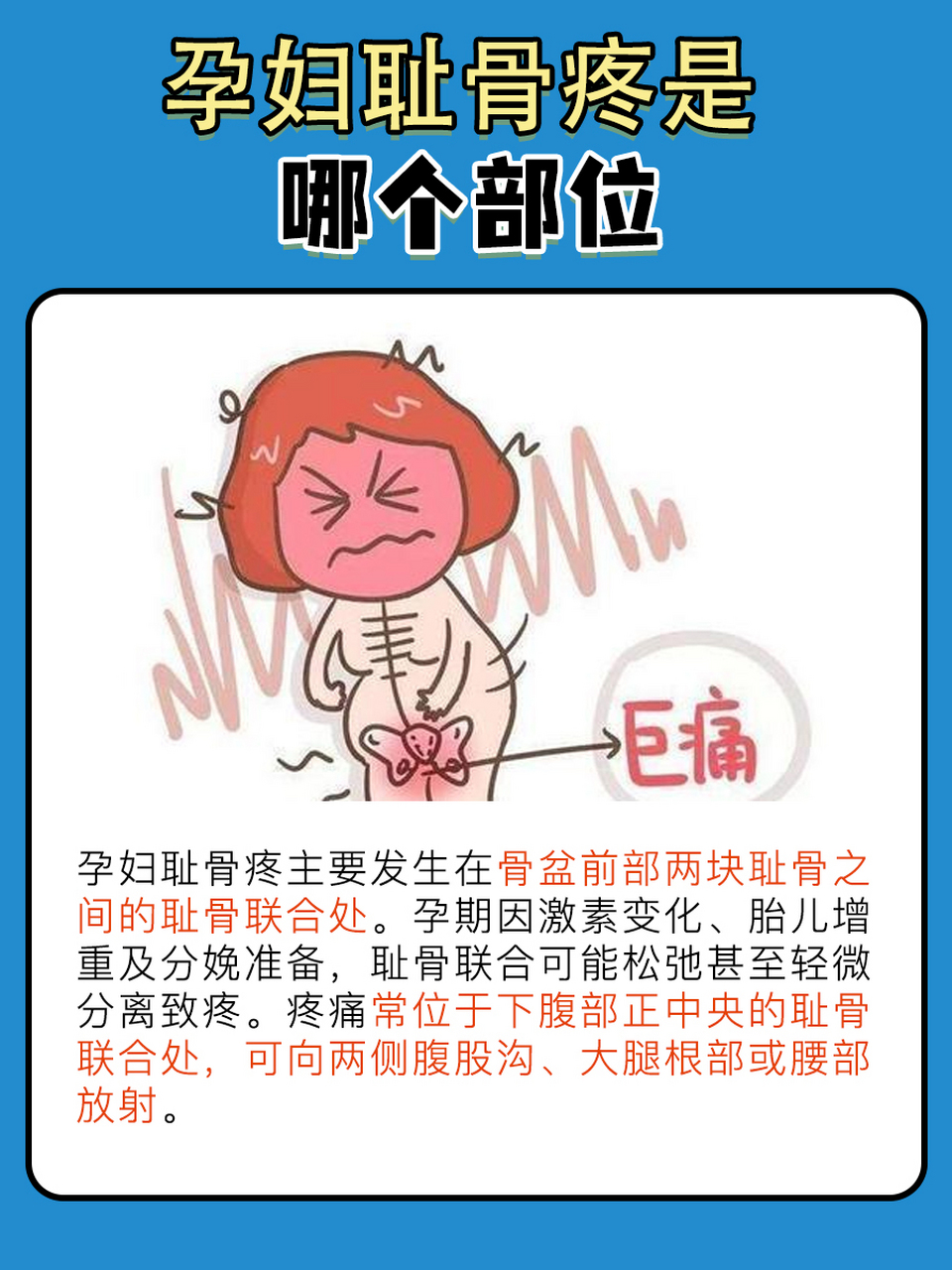 孕妇耻骨疼是哪个部位图解  91孕期中,随着胎儿的逐渐成长,孕妇的