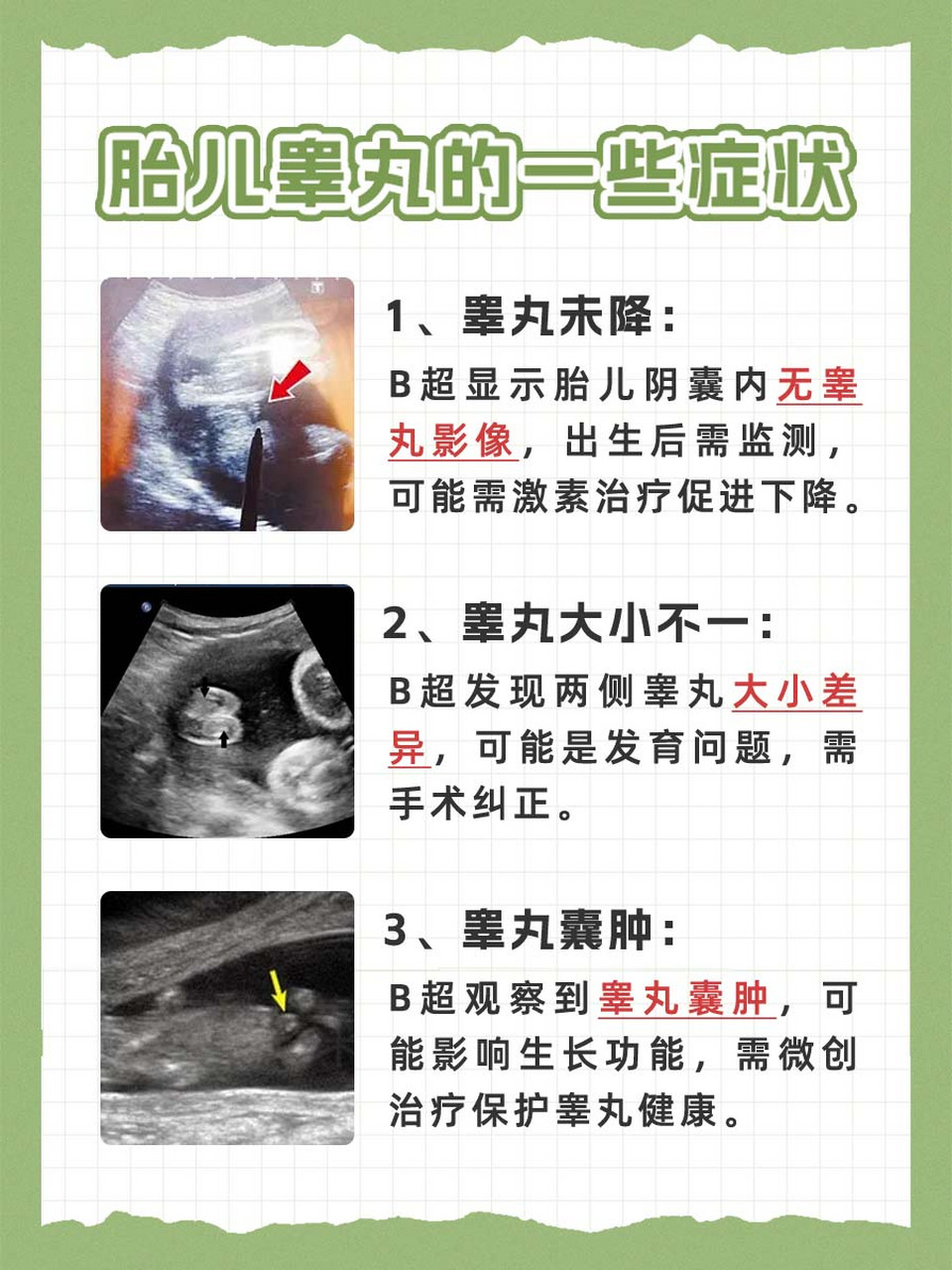 b超胎儿睾丸影像图  93b超检查是一种常用的医学影