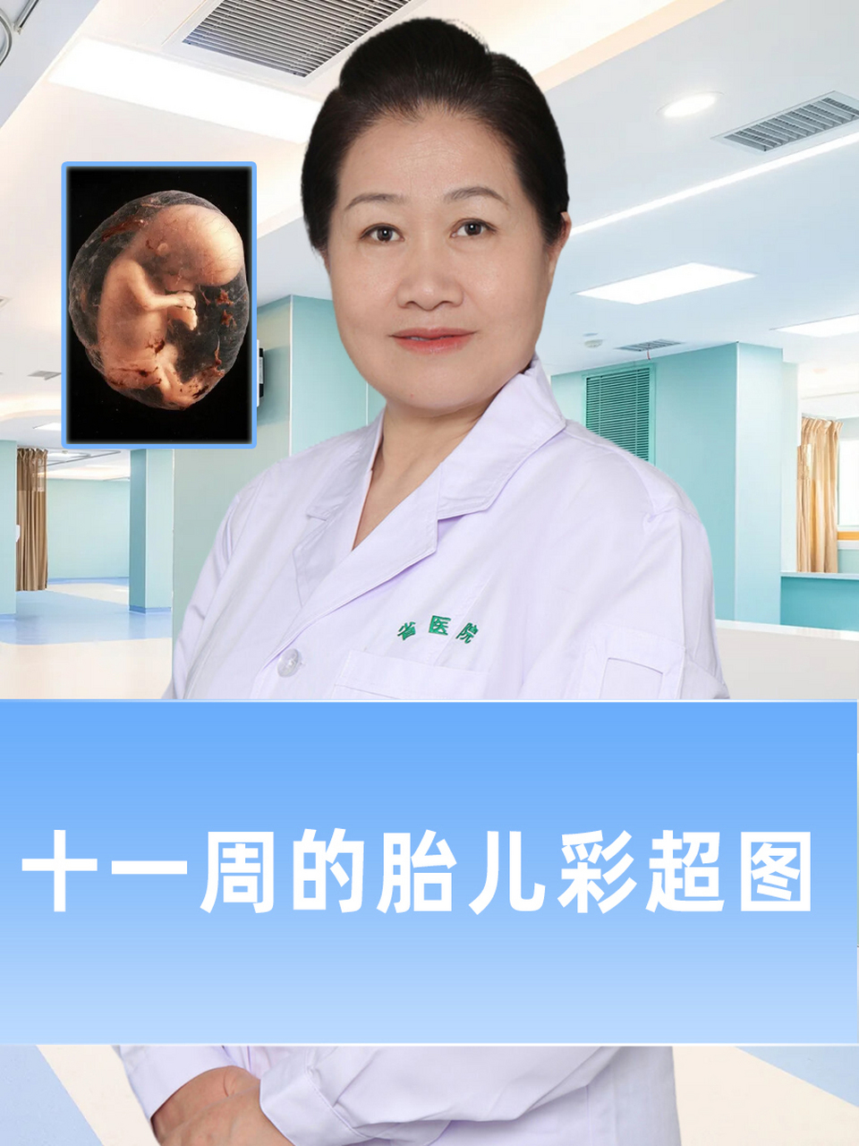 此时,胎儿的头臀长通常在4.5厘米左右.