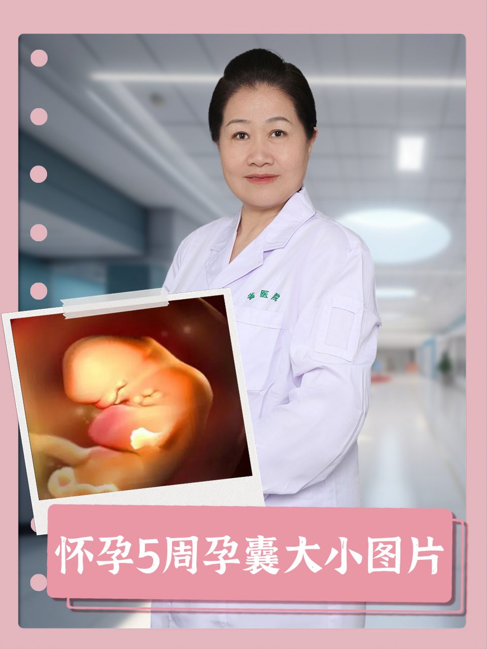 怀孕5周孕囊大小图片  怀孕5周是孕早期的关键阶段,孕囊的大小有着