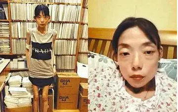 香港模特伍智恒的豪门悲剧:从星光璀璨到身心俱疲