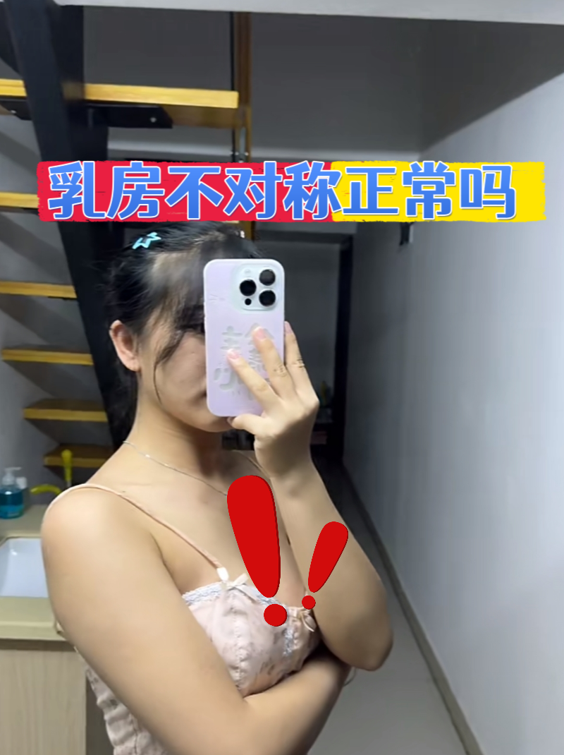 乳房不对称其实是很多女性都遇到过的情况,就像人的左右手不会完纫换