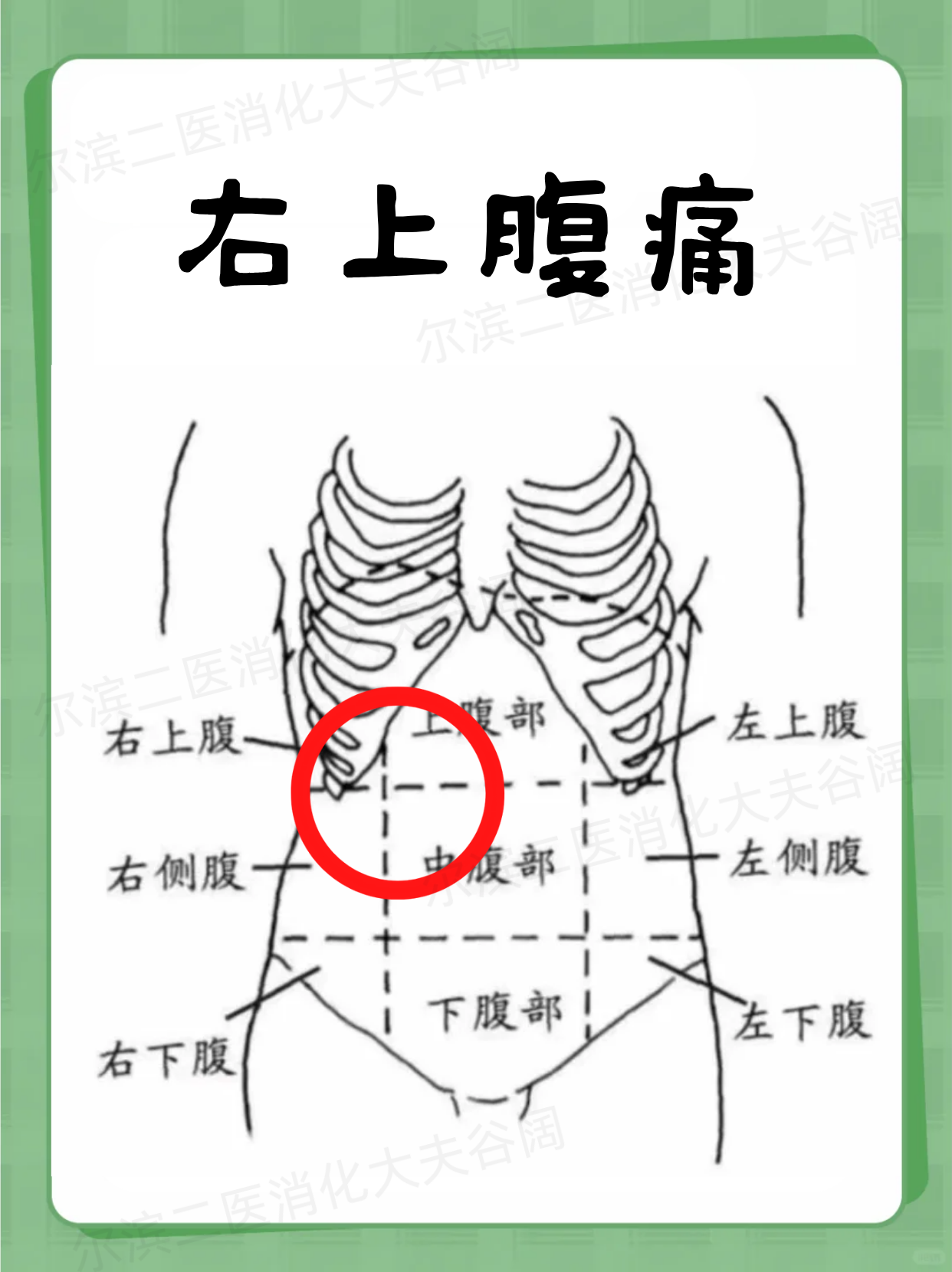 具体胰腺疼是哪个部位疼腹部右上方疼痛位置图胃部疼痛部位对照表