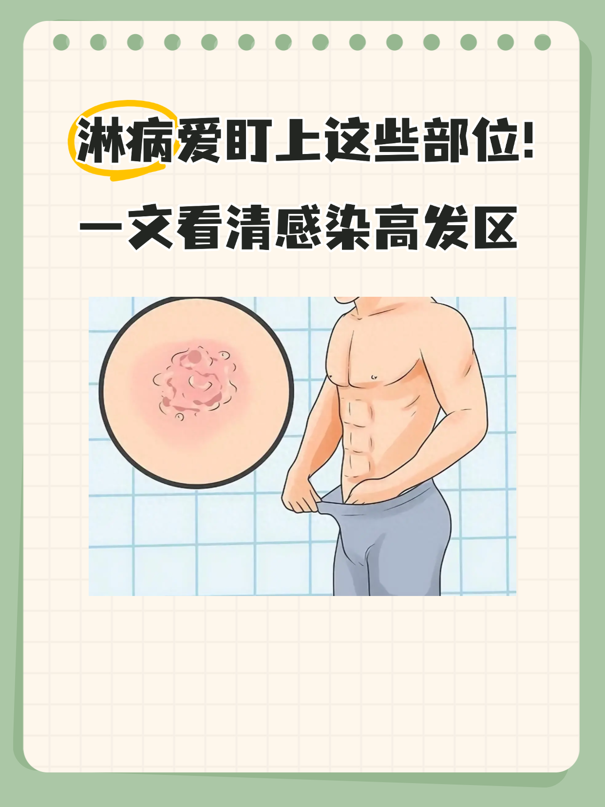 别大意,这可能是淋病在"作祟"!
