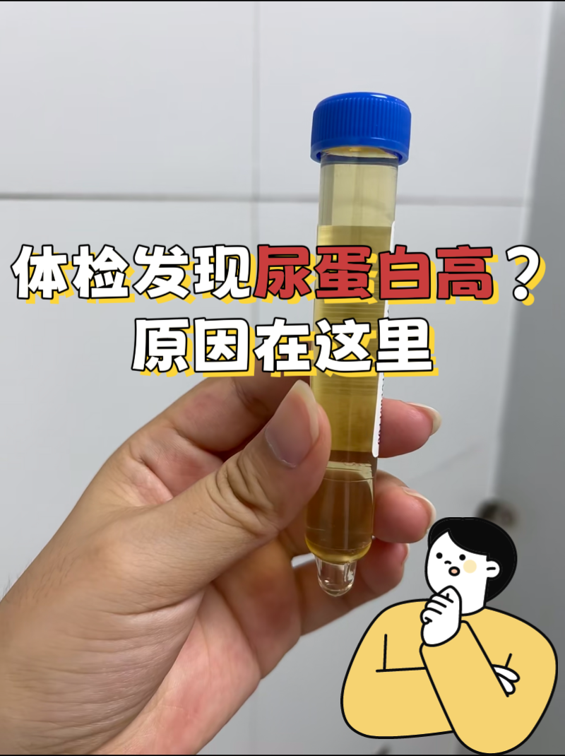 尿蛋白高的常见原因 生理因素 饮 蛋白尿的症状图片尿蛋白静置半个