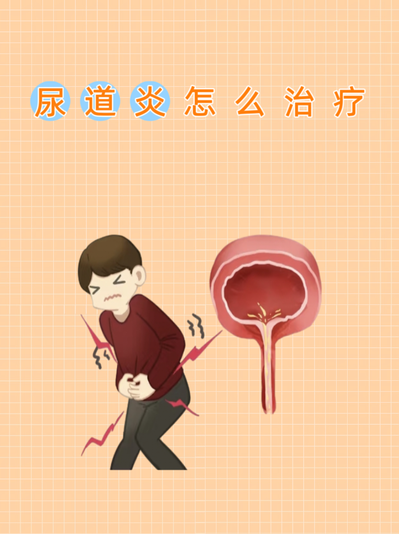 尿路为什么会感染 尿路为什么会感染