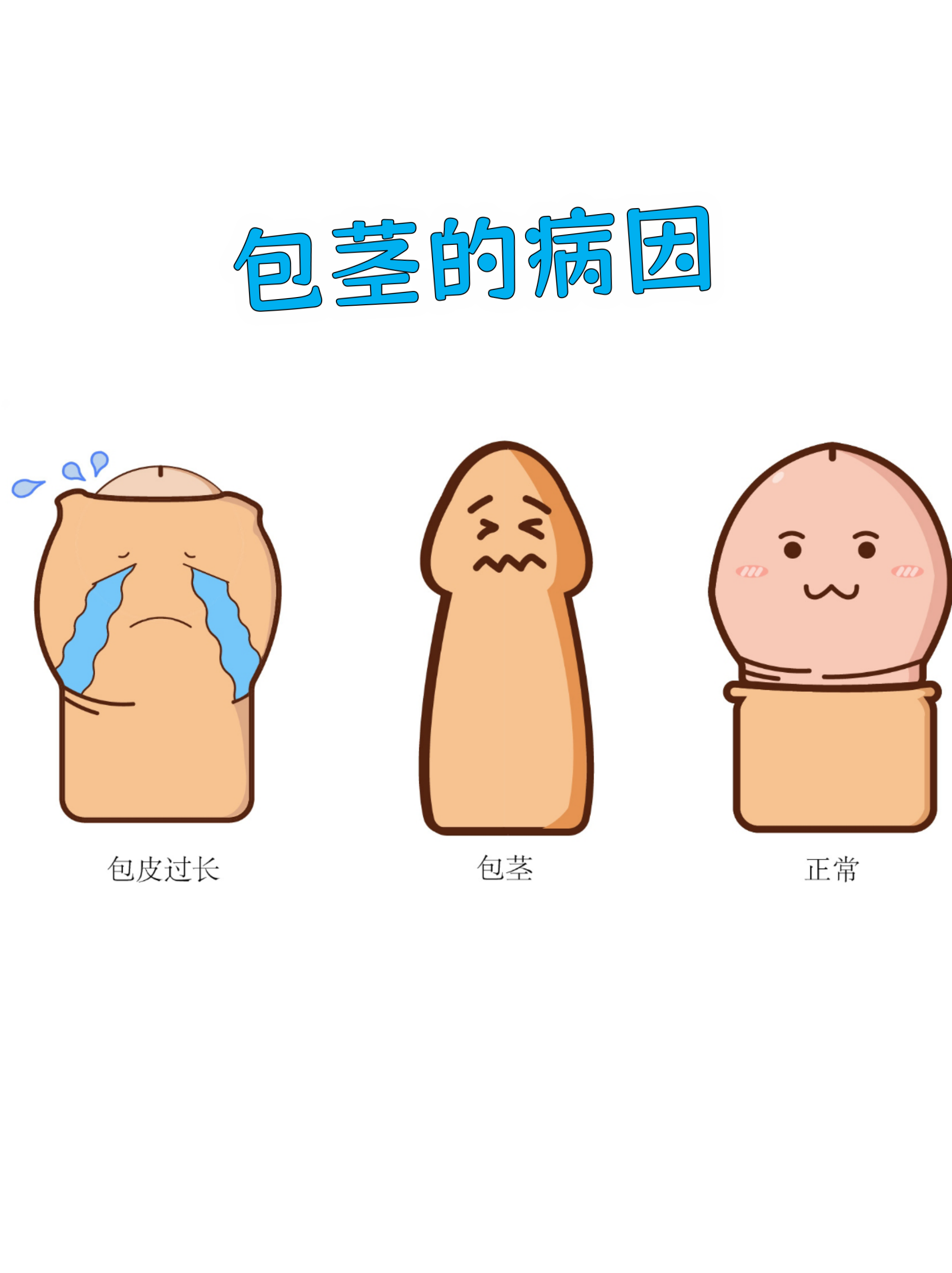 包茎是男性常见的生理现象,但背后可能隐藏着多种诱因