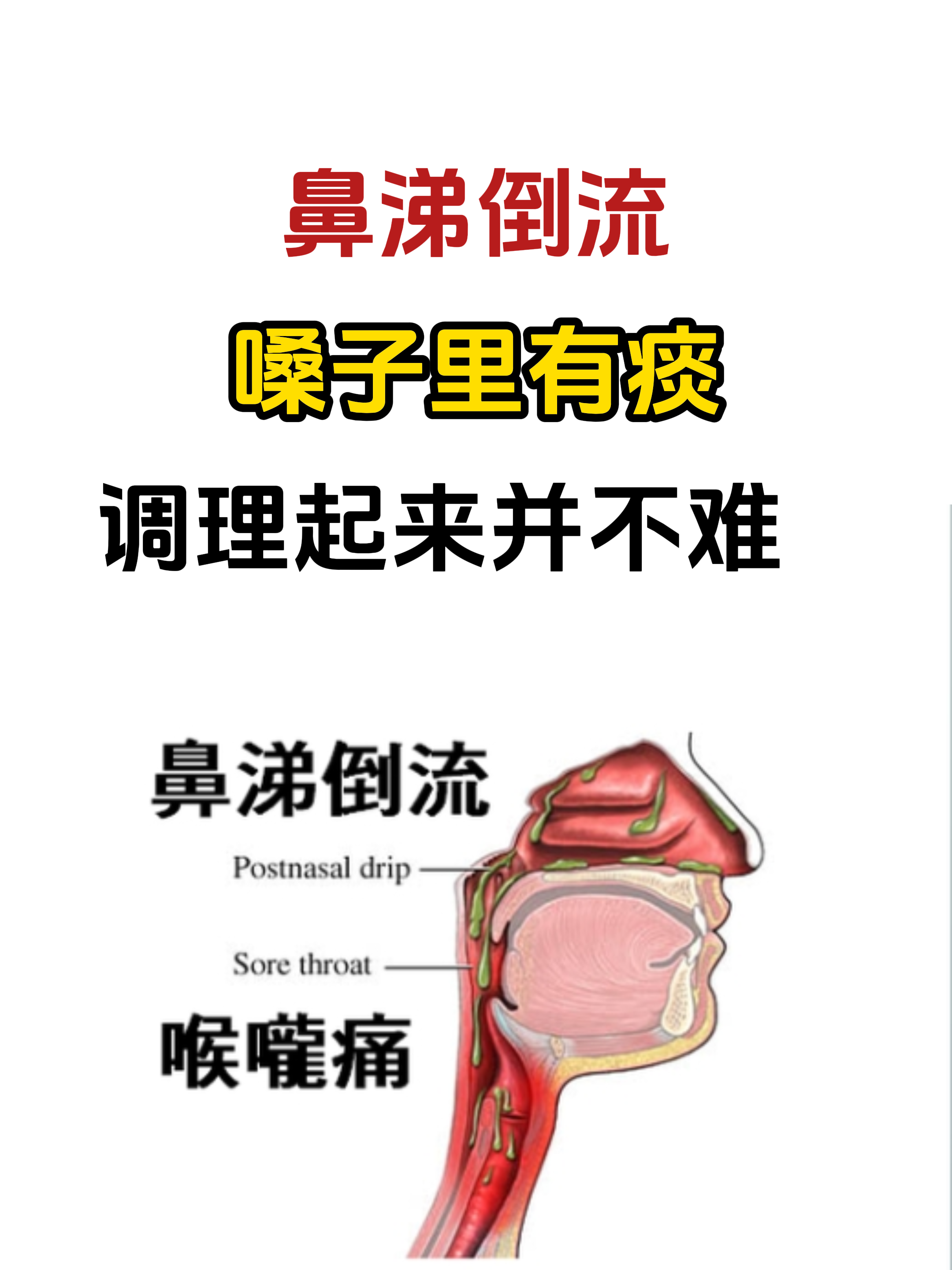 鼻涕存在鼻子部位图片图片