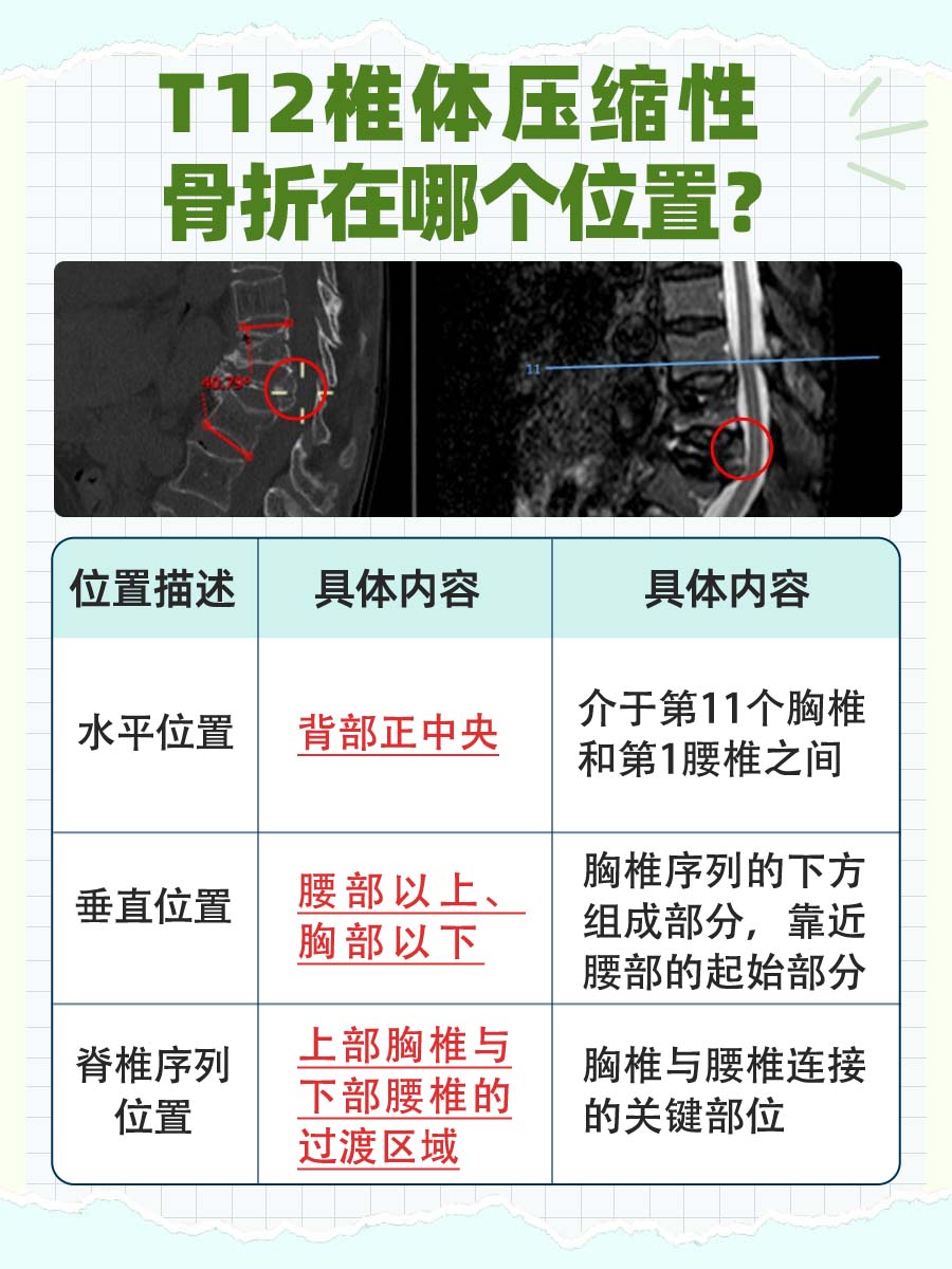 意外的痛 胸12椎体压缩性骨折的位置在哪里 胸12椎体压缩性骨折