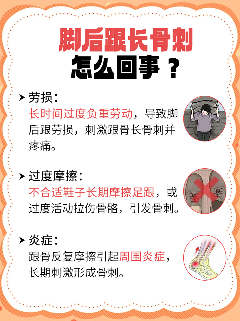 一文带你了解  08脚后跟长骨刺,医学上称为跟骨骨刺,是一种常见于中