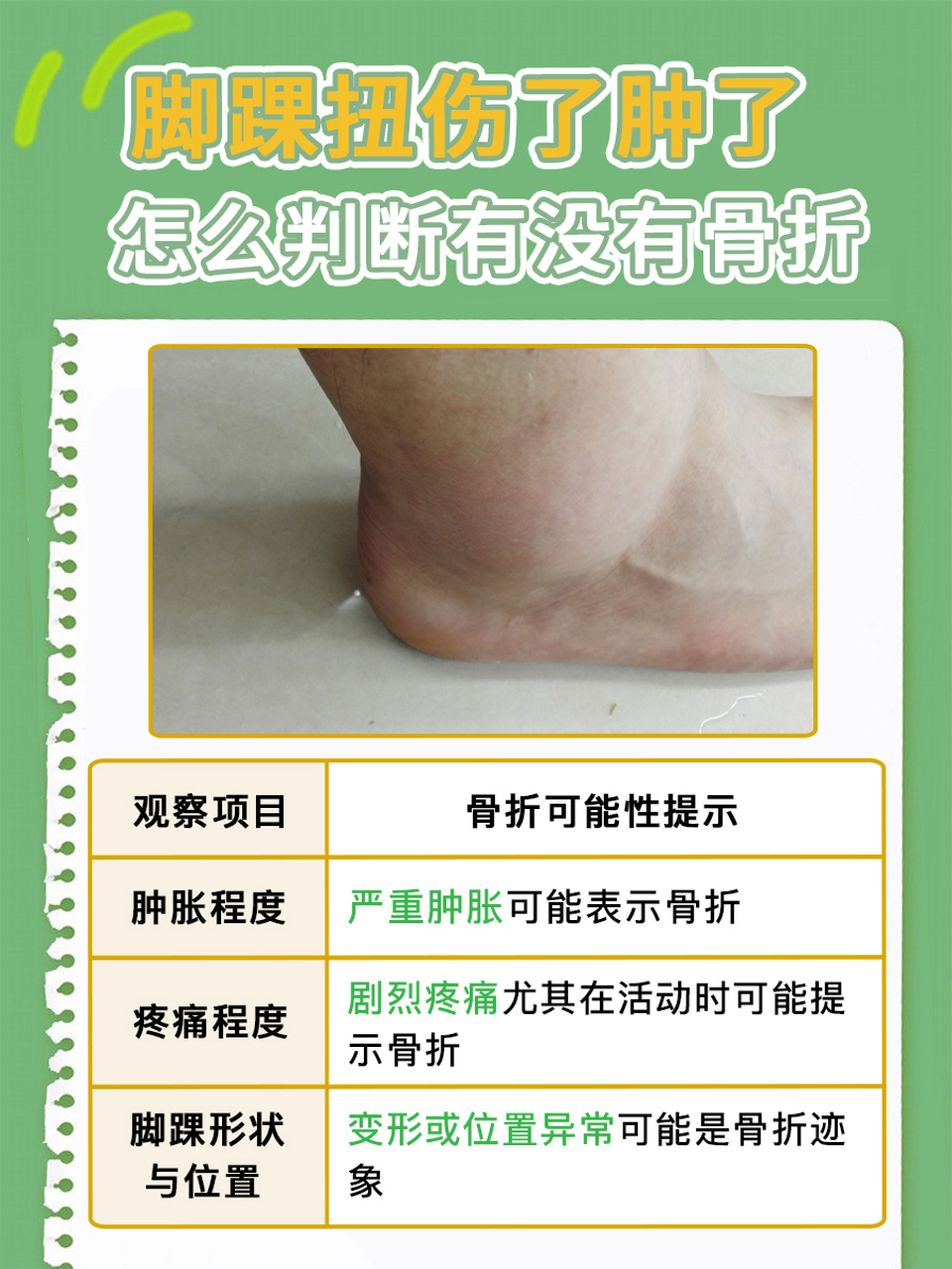 脚踝扭伤肿胀,如何判断是否伴随骨折?