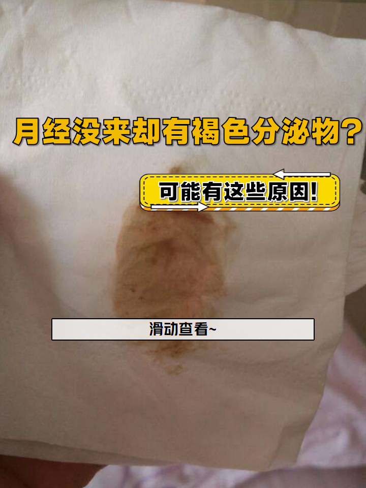 前有褐色的血又不像月经排卵期出血一般持续几月经没来却有褐色分泌物