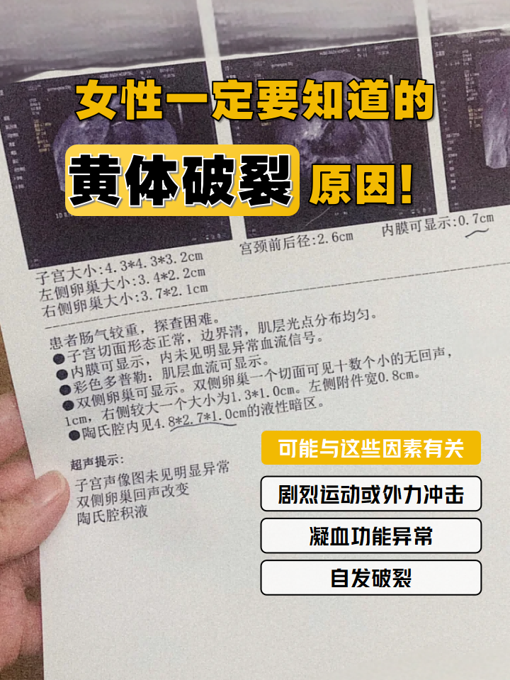 突然的下腹剧痛,伴随头晕乏力