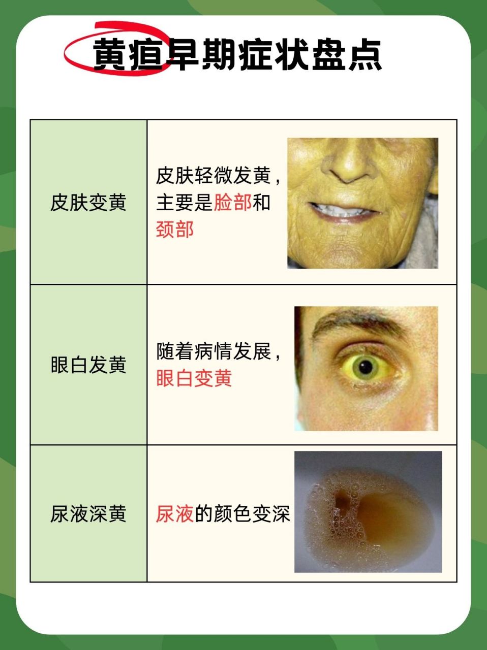 黄疸,听起来可能有些陌生,但它其实是身体在向我们发出的一种"求救