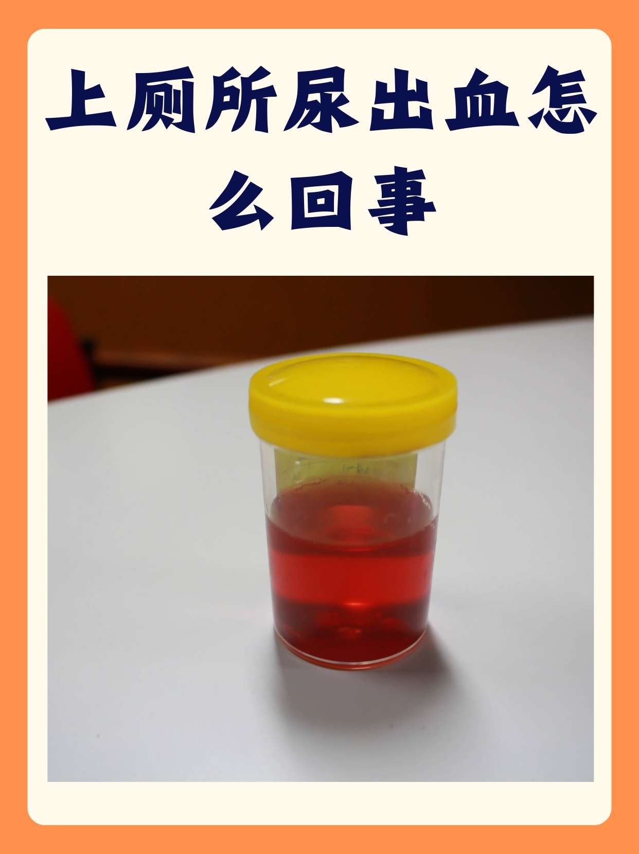 肾结石尿血是怎么回事8岁女孩小便有血怎么回事尿里带血图片医院厕所