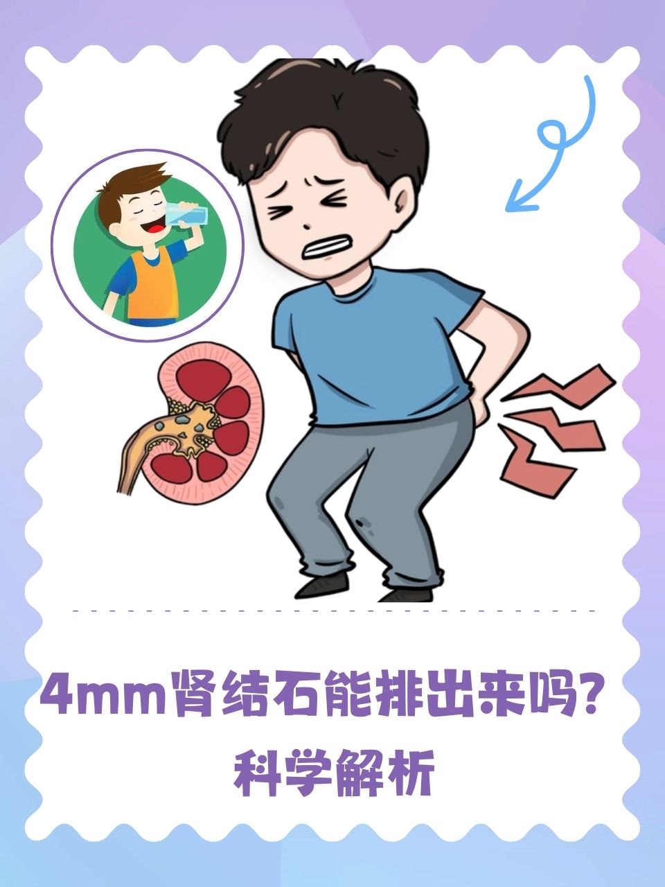 科学解析  肾结石这一看似不起眼的小问题,实则给许多患者带来了极大