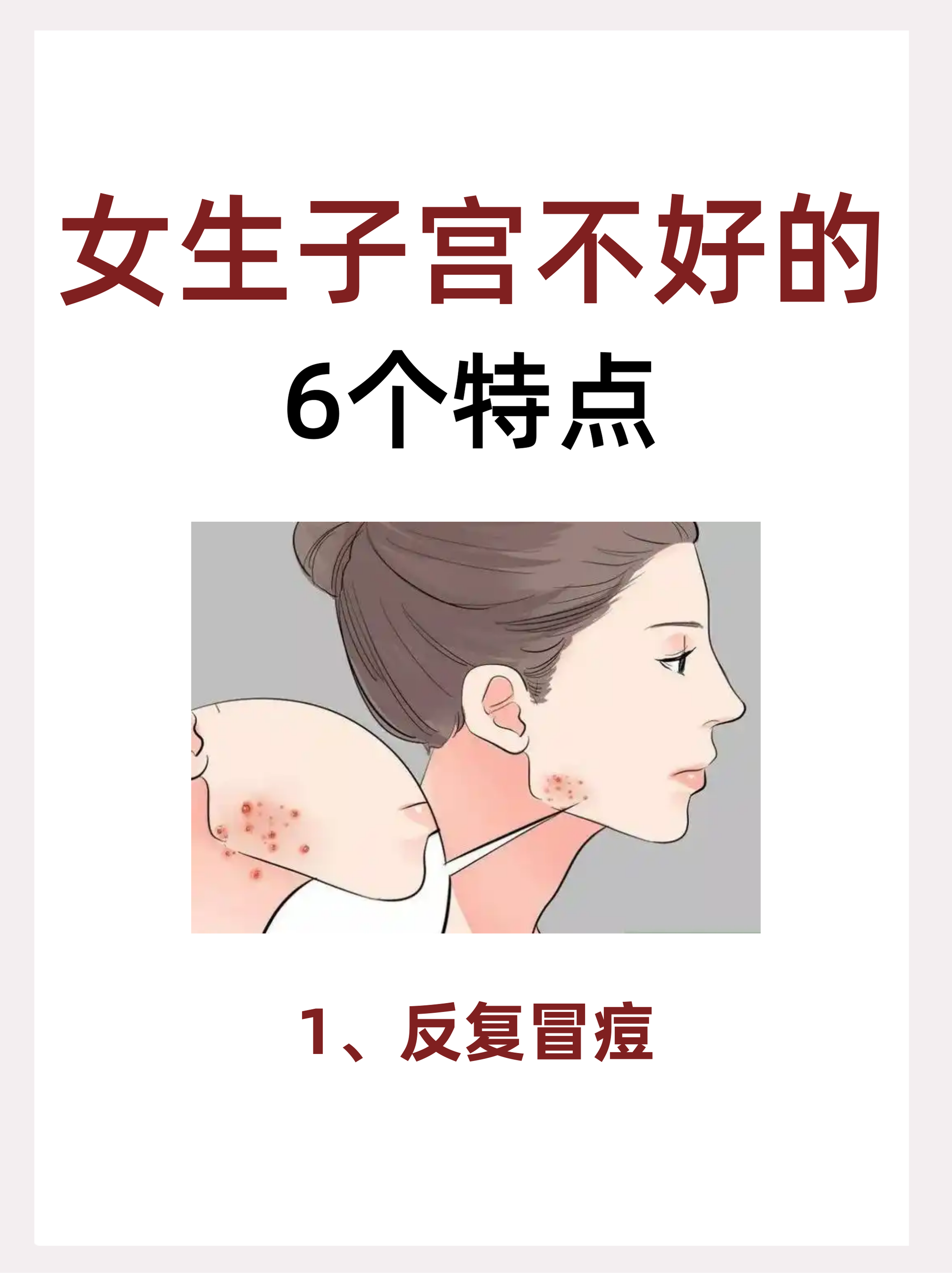 为什么来大姨妈时会长痘百科在线 为什么来大姨妈时会长痘百科在线