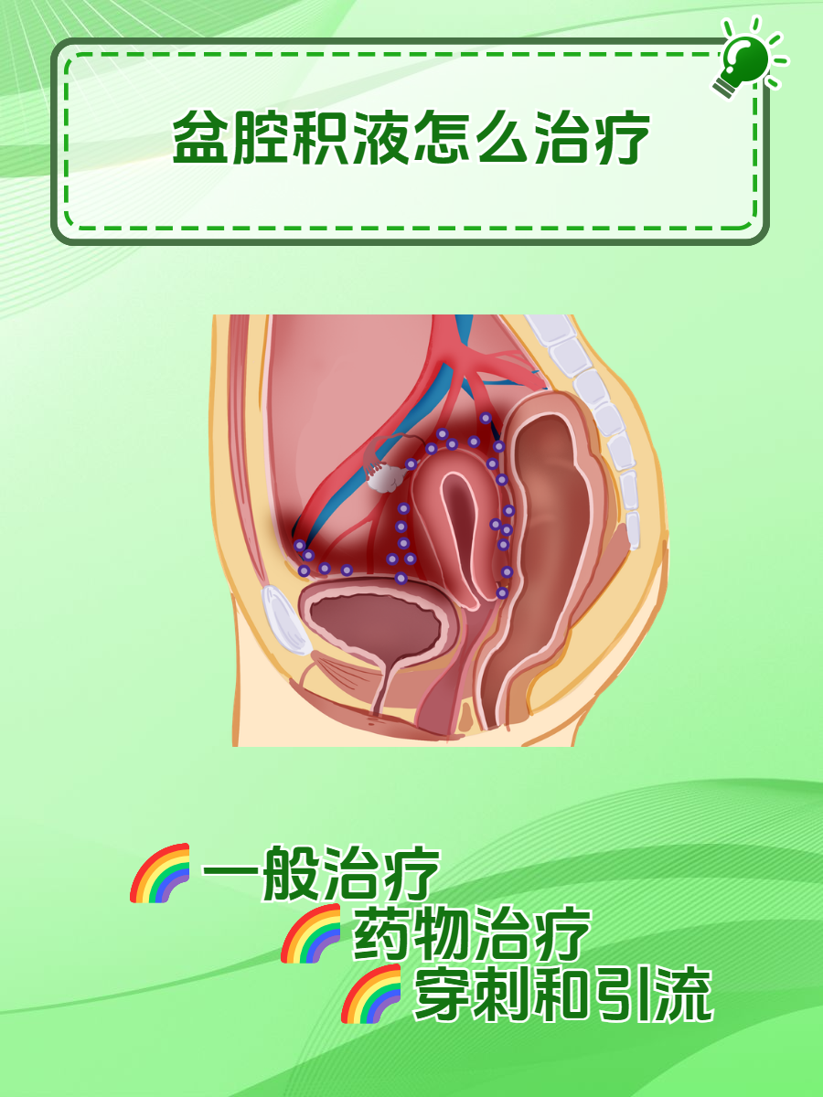 治疗方法全在这里  盆腔积液是妇科常见的一种症状,它不仅影响女性的
