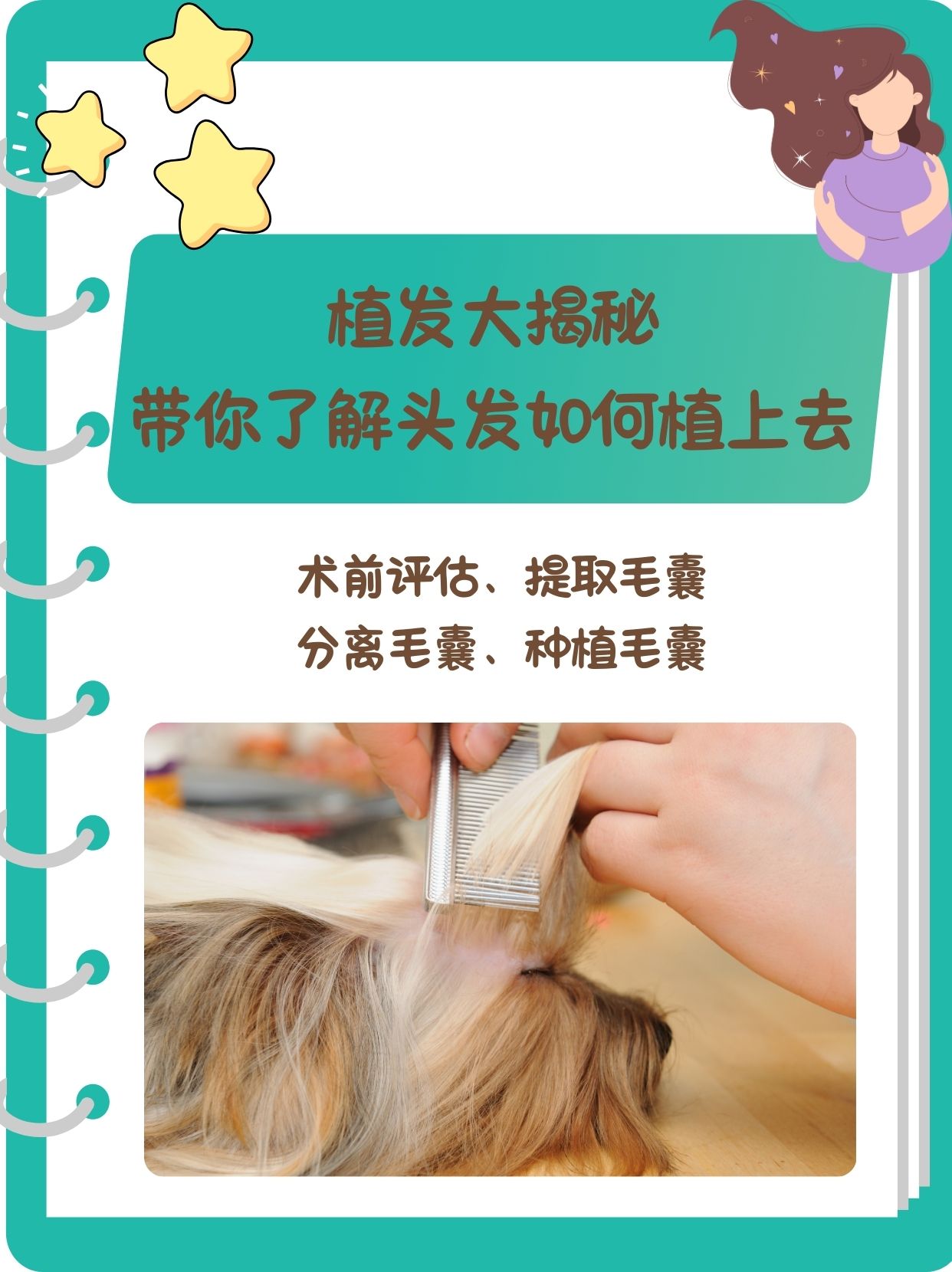 新移植的毛囊会在脱发区域生长出自然的头发从而改善头发稀疏或秃发