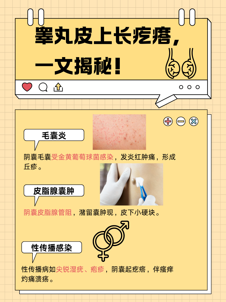 睾丸皮上长疙瘩,可能是清洁没做好,引发了炎症,也可能是皮肤