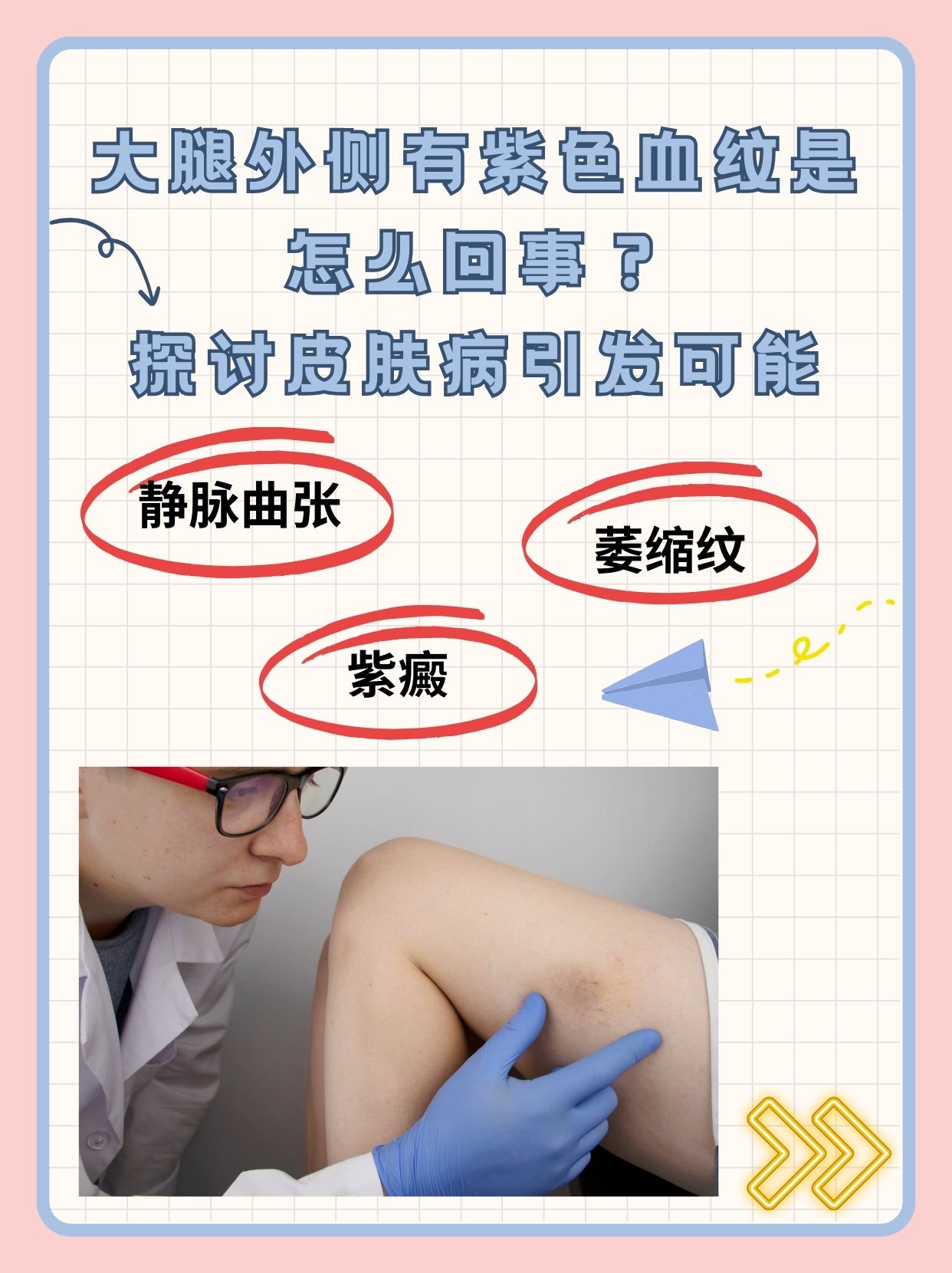 大腿外侧有紫色血纹是怎么回事?