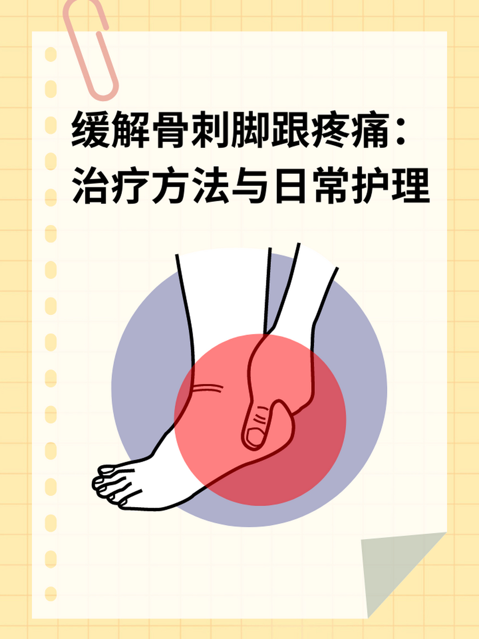 97缓解骨刺脚跟疼痛:治疗方法与日常护理 67骨刺,也称为骨赘,是一