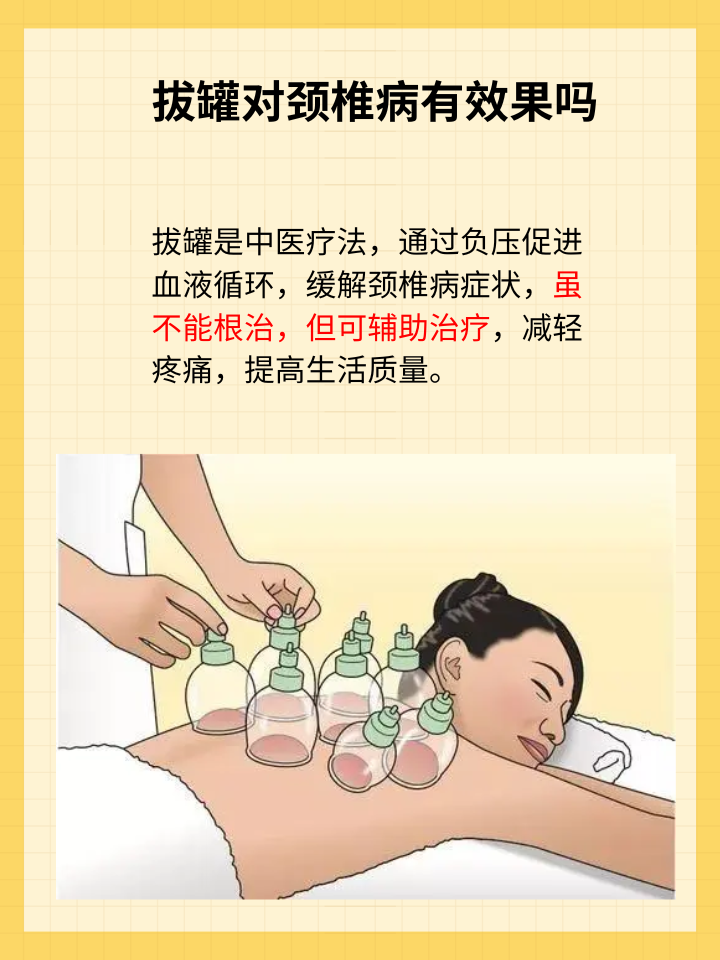 拔罐治疗颈椎病:真的有效吗?
