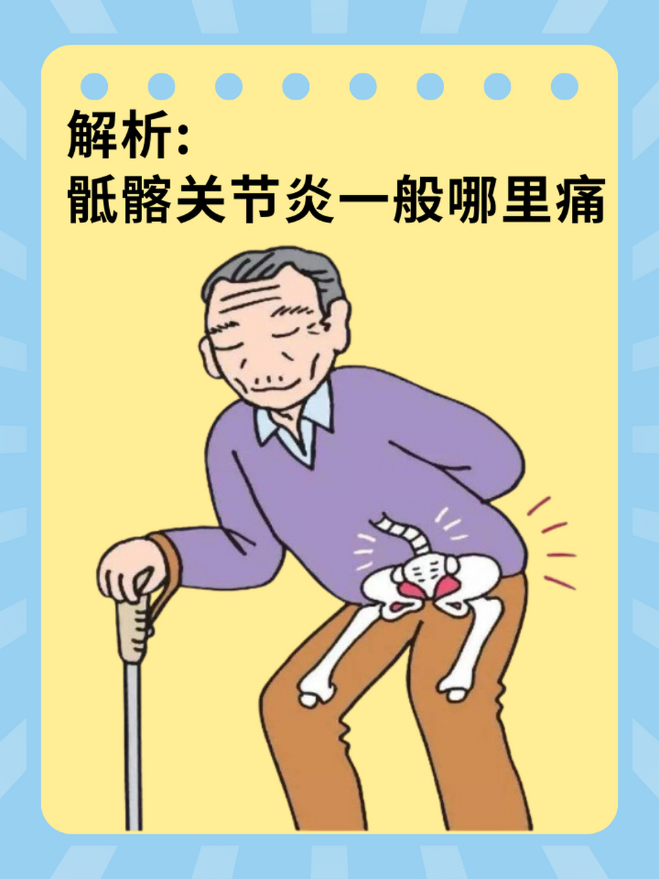 那么,骶髂关节炎通常会导致哪些部位出现疼痛呢? 🌈以下是骶髂关节