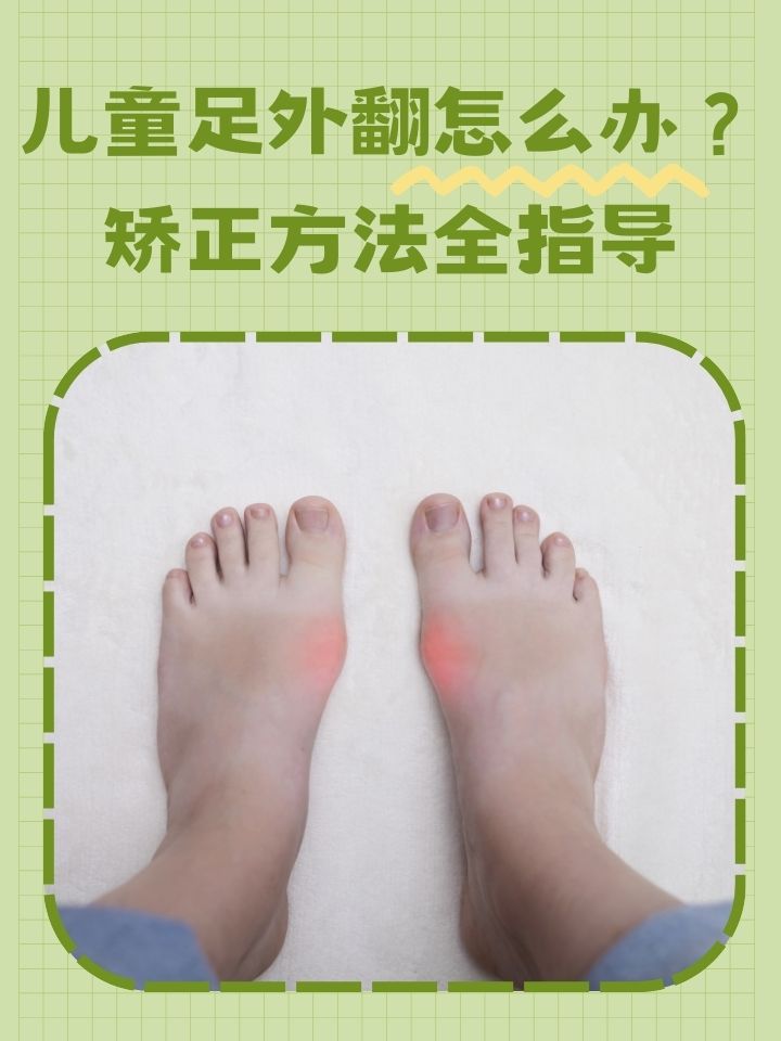 儿童足外翻怎么办?