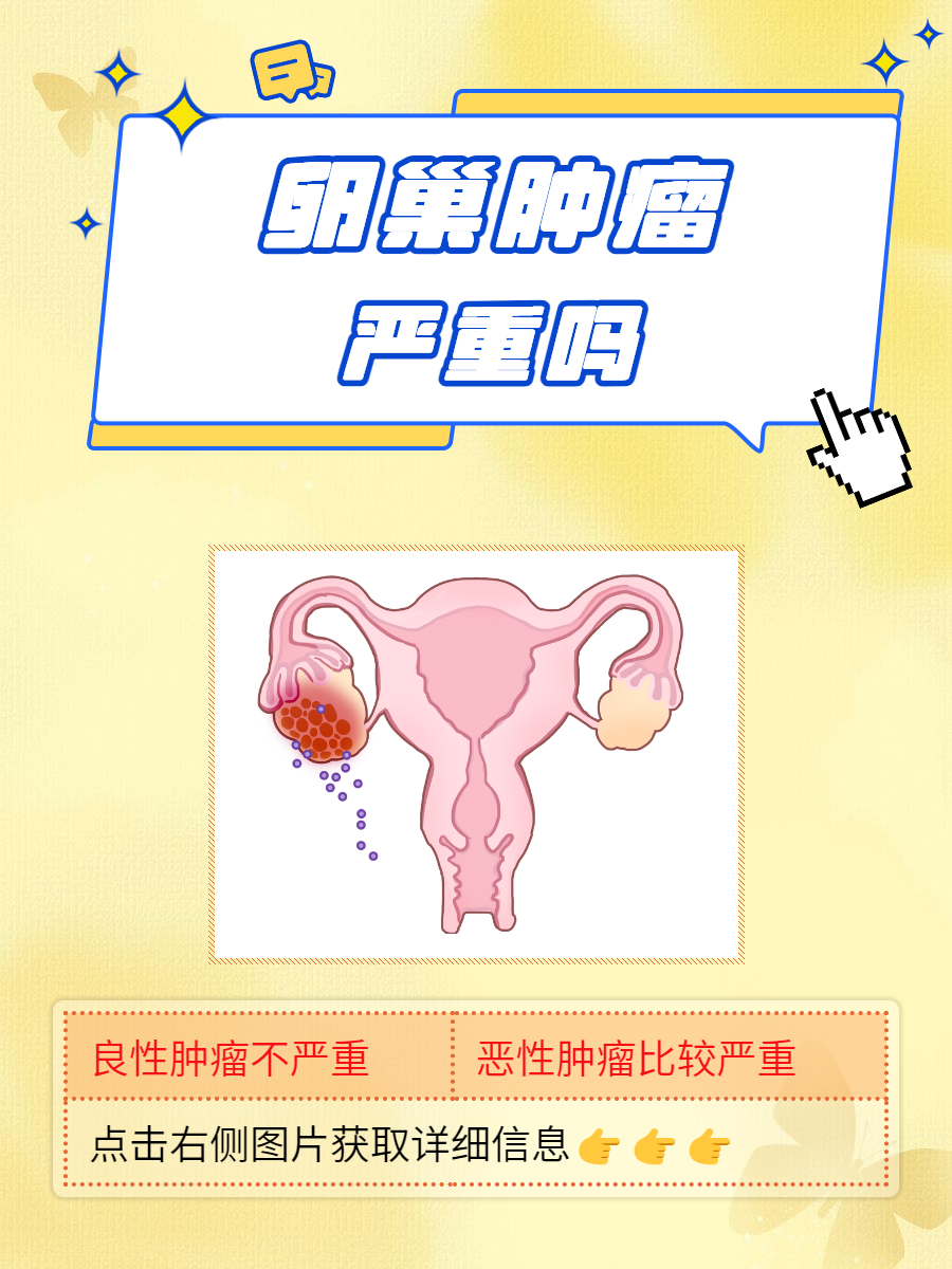 为什么会出现卵巢囊肿的原因为什么在线