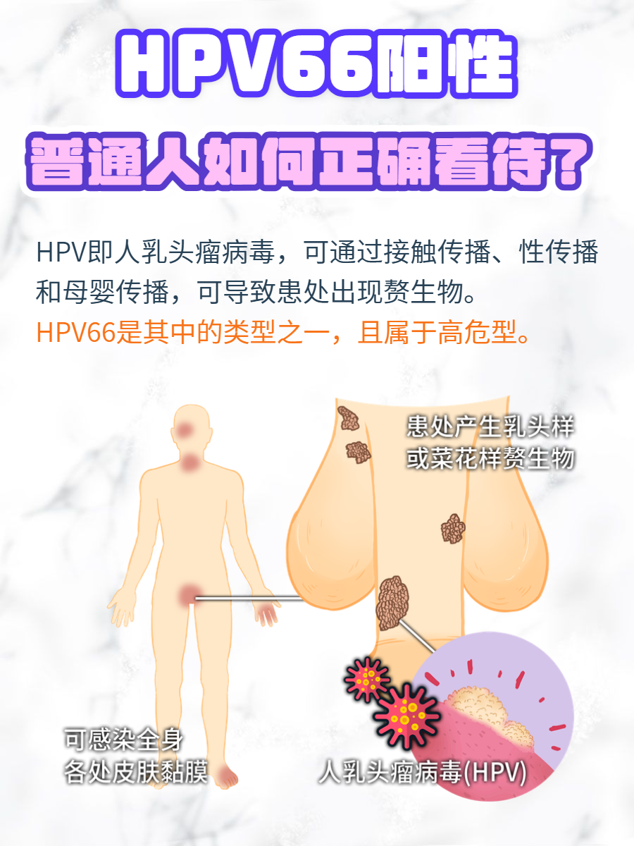hpv68阳性严重吗hpv病毒感染是什么原因引起的hpv66hpv是什么意思是