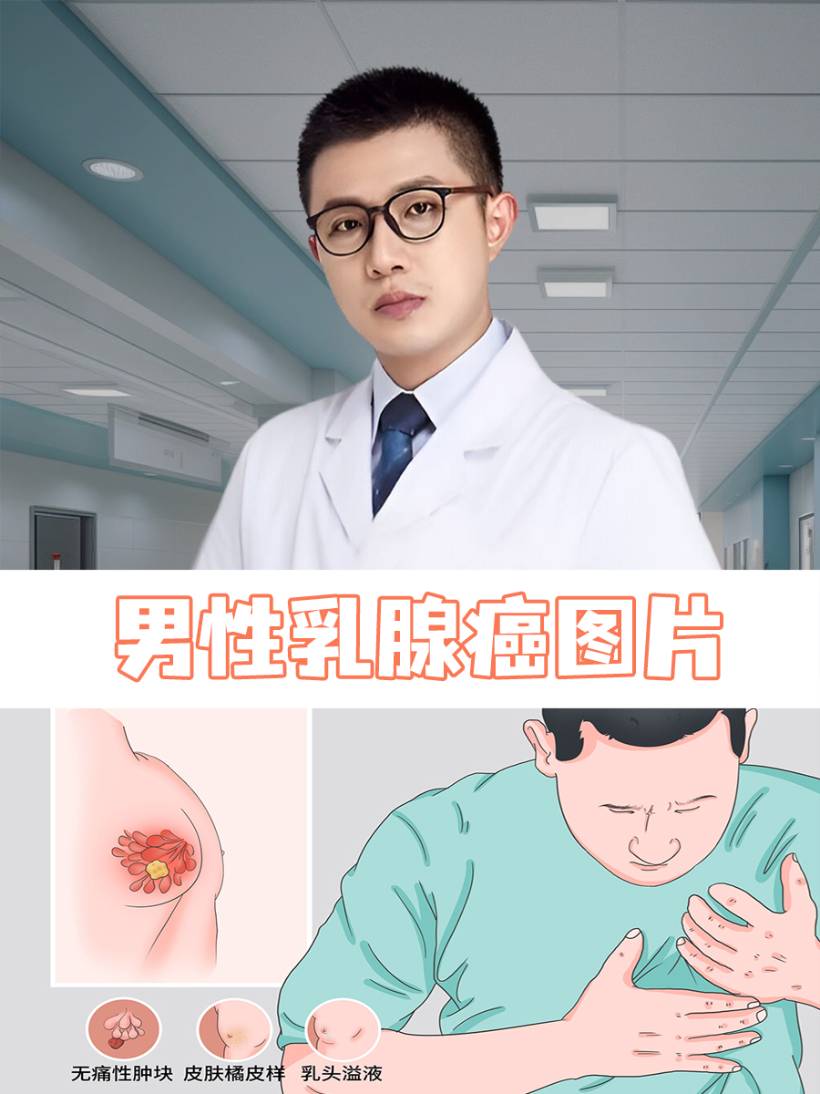 男性乳腺癌什么症状图片