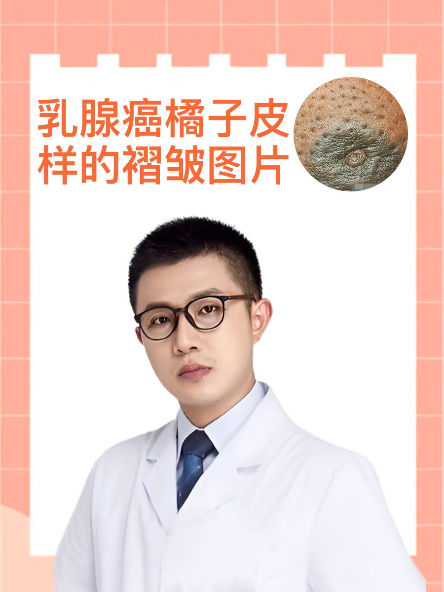 橘皮样乳房 症状图片