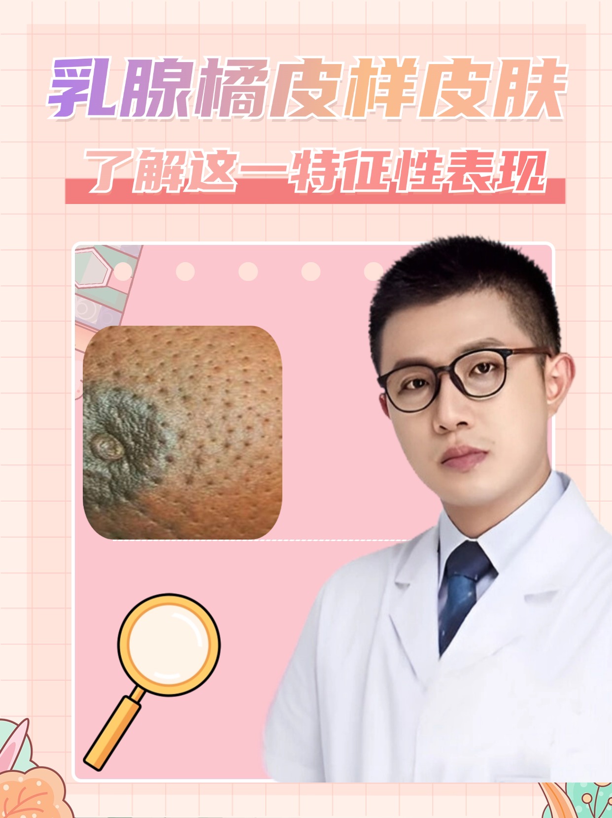 乳腺橘皮样皮肤 了解这一特征性表现  在乳腺健康的科普话题中