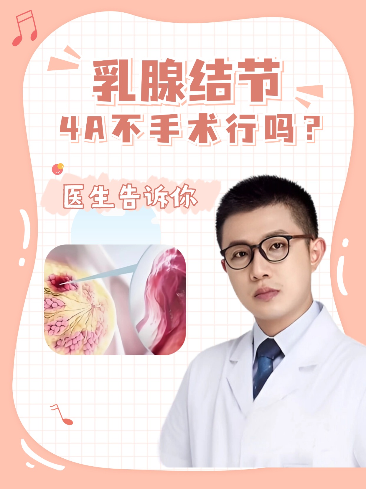 乳腺结节4a类严重吗图片