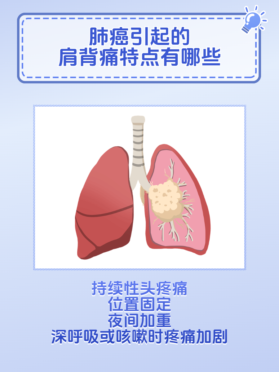 肺癌前期五个身体信号图片