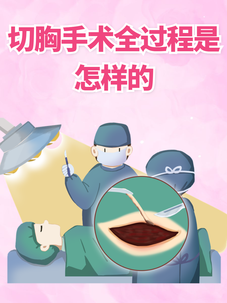 切胸手术全过程是怎样的?