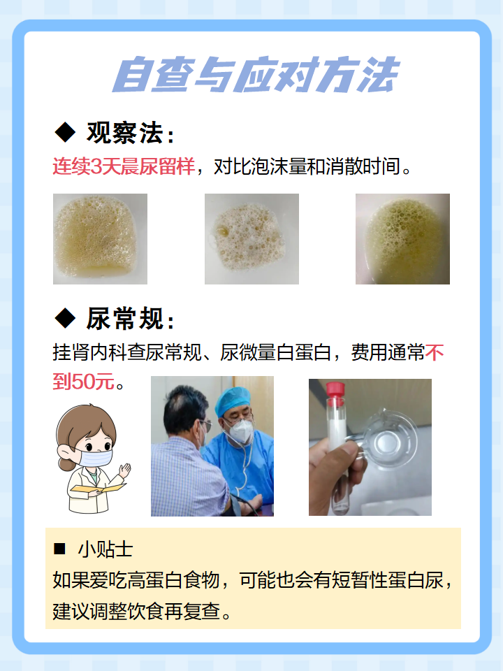 出现泡沫尿,可能有以下原因: 生理性 蛋白尿 泌尿感