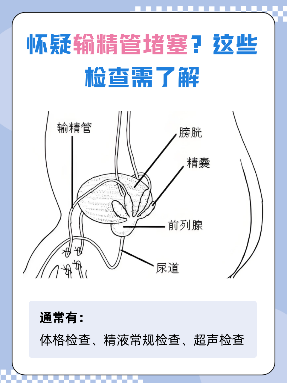 怀疑输精管堵塞?
