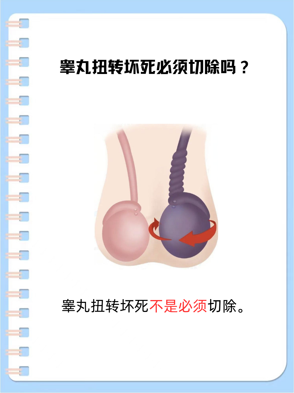睾丸扭转发作时,那种剧烈的疼痛让人难以忍受,而当出现睾丸坏死时