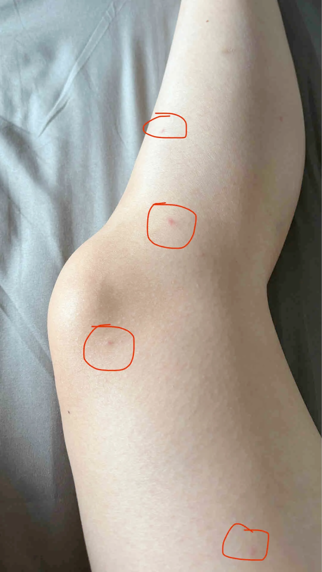 有没有hpv,看看双腿变化或明白