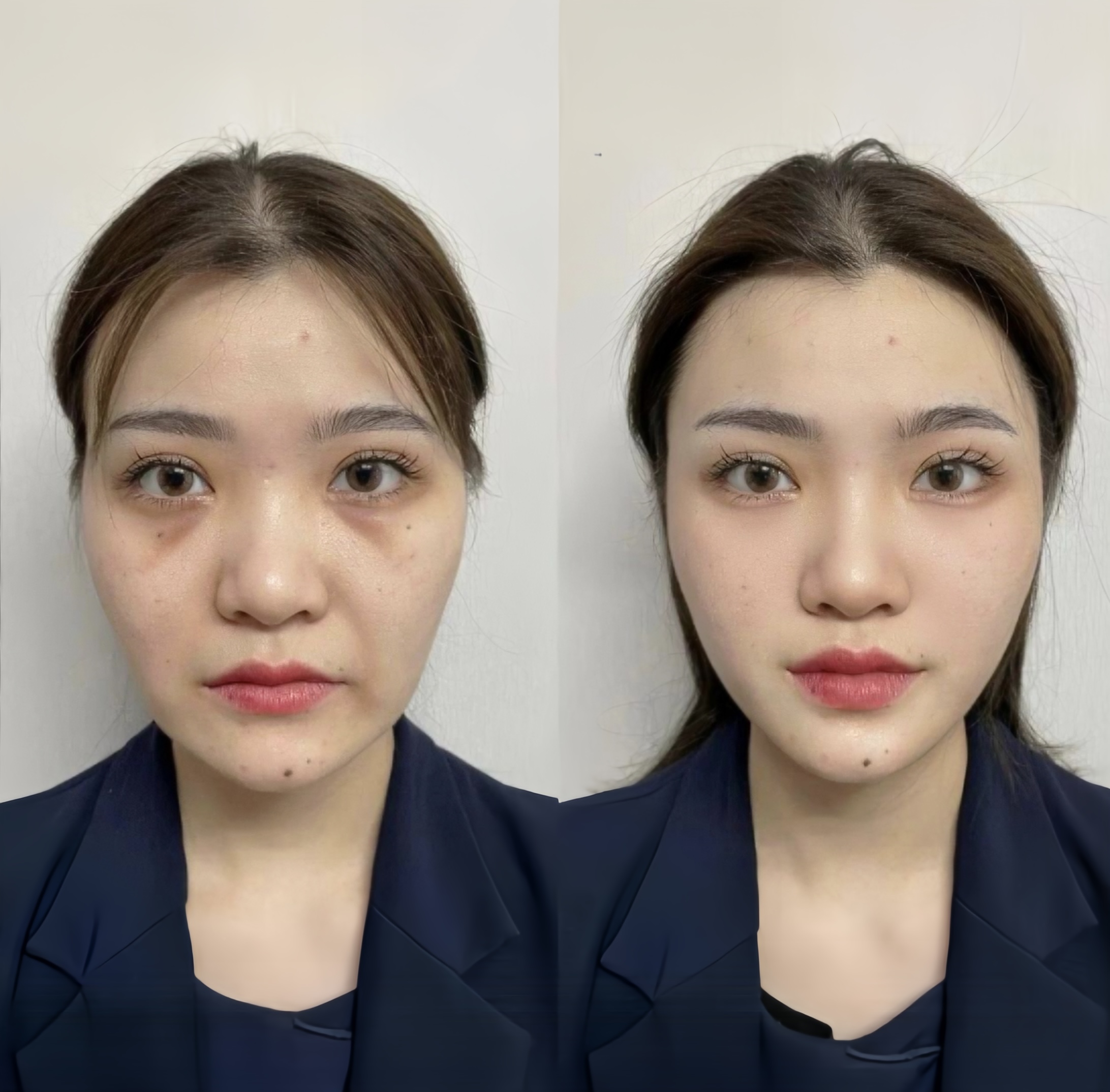 看着却比同龄人老了10岁33岁和23岁的区别33岁和43岁对比照正常脸黄和