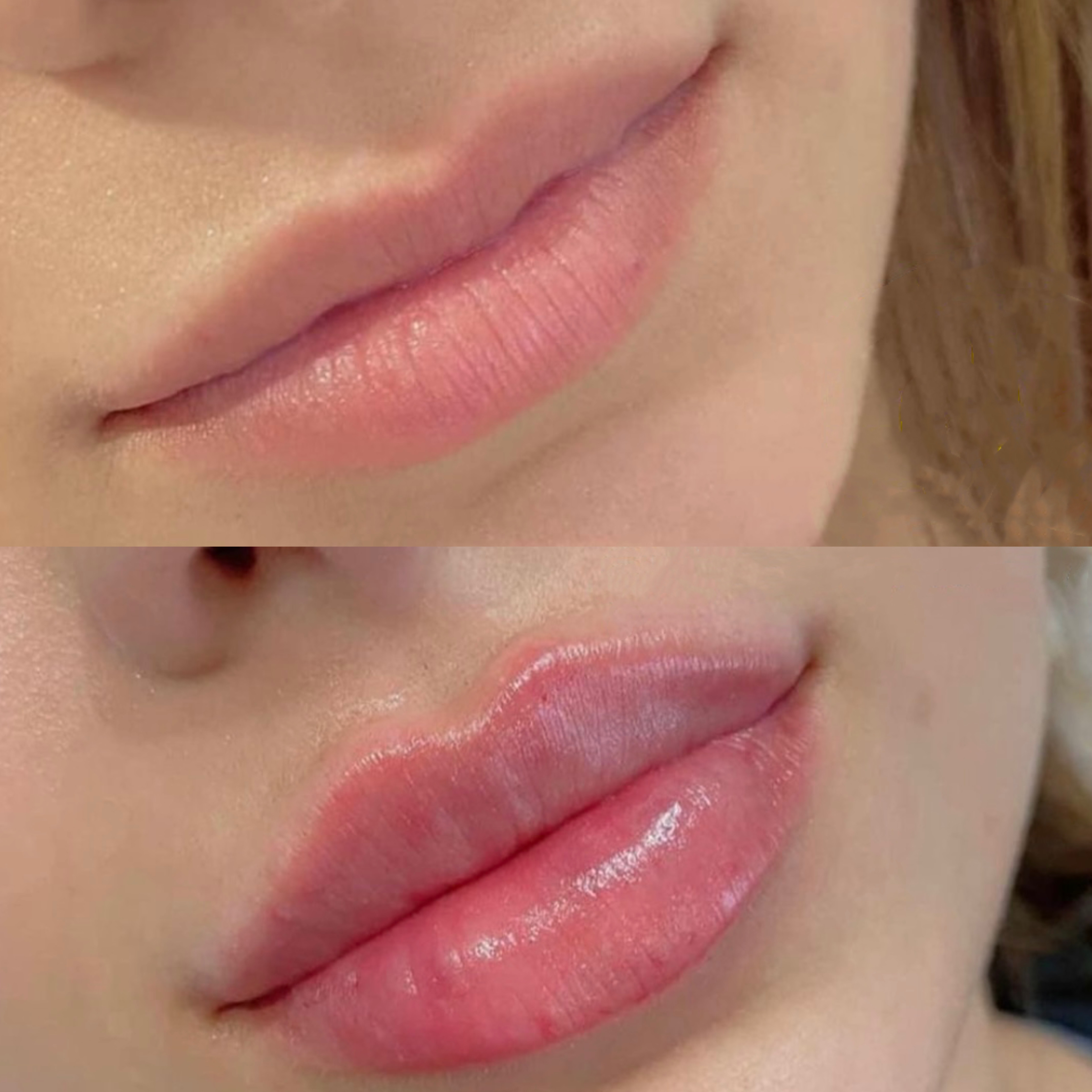 以前的嘴唇不说很丑,但是确实也不是很好看,希望